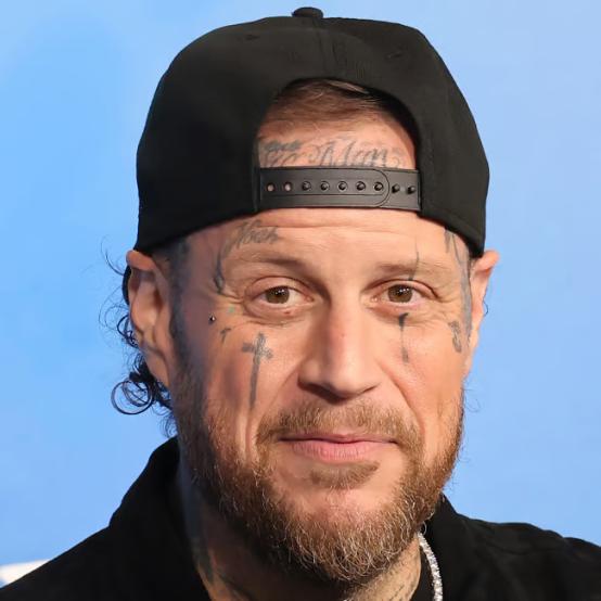 Джеллі Ролл відверто розповів фанатам про труднощі на шляху схуднення