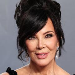 Кріс Дженнер розчарована результатами підтяжки обличчя через короткотривалий ефект