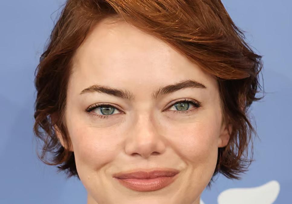 Емма Стоун спричинила палкі дискусії на BAFTA 2026 через своє надмірне схуднення