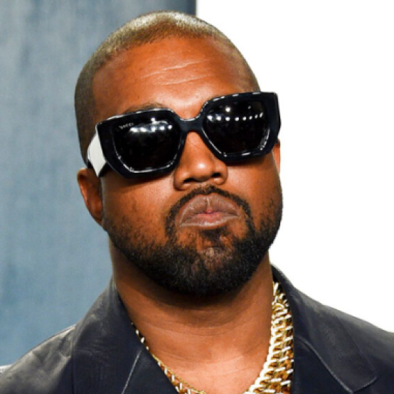 Каньє Вест зробив титанові зубні протези за майже мільйон доларів