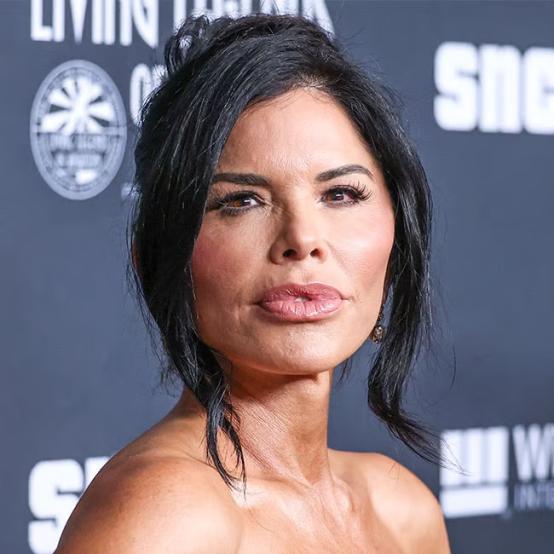 Лорен Санчес змінила своє обличчя: хірурги підозрюють міграцію філерів